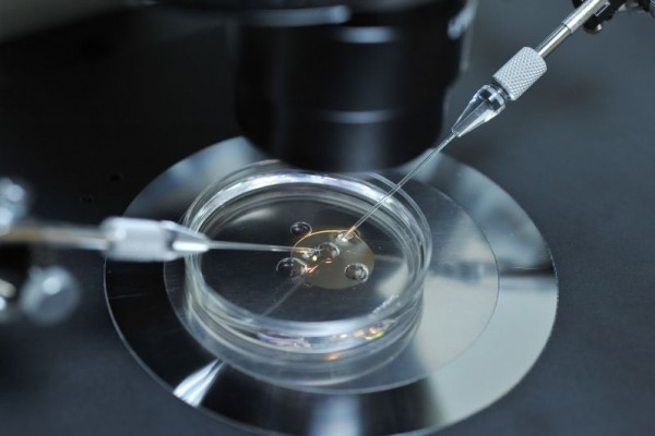 Liječenje neplodnosti: